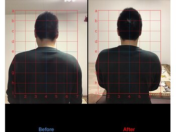ストレチックス 近江八幡店/姿勢・腰痛改善ビフォーアフター