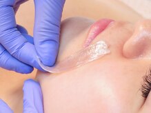 キアラ 麻布十番(Kiara)/大人気フェイシャル脱毛