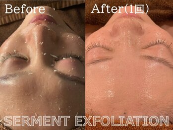 ルナステラ 金沢店/セルマン艶肌ピーリング