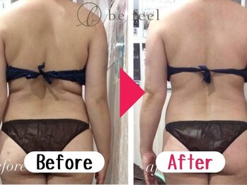 ビーフィール 池袋店(be feel)の写真/【SNSで人気沸騰!】池袋で大人気!痩身クーポン2980円~落ちない脂肪は最新マシンとハンドで徹底撃退!