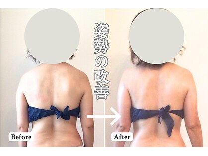 ハナ(hana)の写真