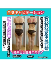 ビューティ ウィッチ(Beauty Witch)/