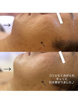 エミュ(e'mu)/ハンド×希少マシンの圧倒的効果