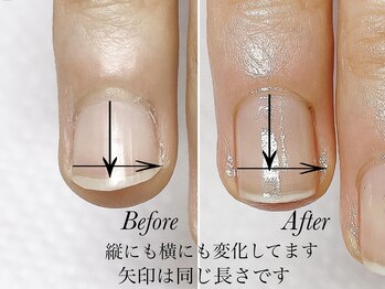 トゥインクリーネイルサロン(Twinkly Nail Salon)/【最強のネイルケア】1回お試し
