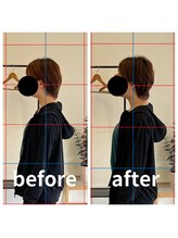 熊本カワル整体 JR上熊本駅院/ストレートネック、巻き肩