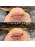 【フェイシャルワックス＋光脱毛】うっかり産毛にも◎9800円