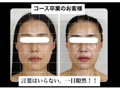 真美(Sinbi)の写真