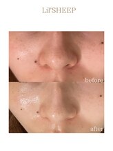 リルシープ(LIL'SHEEP)/REVI陶肌トリートメント