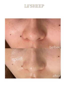 リルシープ(LIL'SHEEP)/REVI陶肌トリートメント