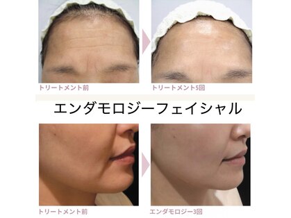 ビノス(Binosu)の写真