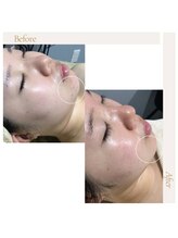 fallon beauty　痩身/フェイシャル/フェム・オムケア/アロマ/ボディケア/ハーブピーリング