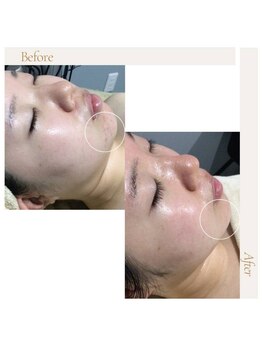 fallon beauty　痩身/フェイシャル/フェム・オムケア/アロマ/ボディケア/ハーブピーリング