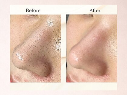 フローラスキン 恵比寿Amour店(florasKIN)の写真