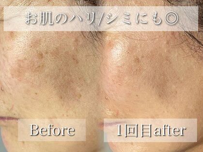 リイル バイ クレビア(REILE by Crebia)の写真