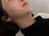 《当店イチオシ》より美容液の浸透しやすいお肌へ！フェイシャル顔脱毛6500円