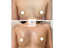 エムクリニカルラボ 藤沢(M clinical lab)の雰囲気（完全個室の空間◇一人一人にベストな施術をスタッフがご提案!!）
