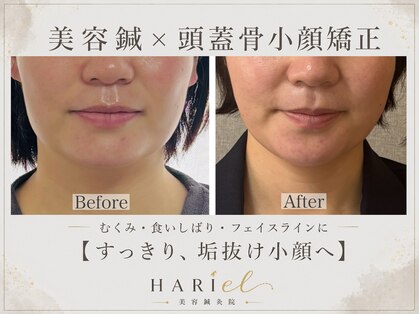 美容鍼灸院ハリエル(HARIel)の写真