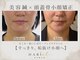美容鍼灸院ハリエル(HARIel)の写真