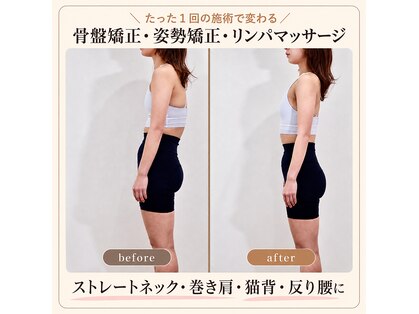 アズール(azure)の写真