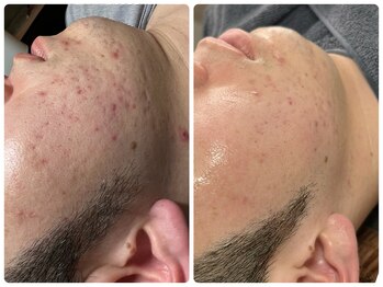 ラナ(Lana)/当店完全オリジナルフェイシャル