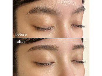 ダン(dan)/【EYEBROW WAX】症例