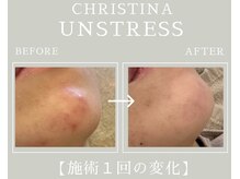セレニテ(Serenite)の雰囲気（トロイアルケ/CHRISTINA/REVI 豊富なラインで悩みに合わせご提案）