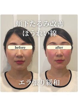 フェアリーフェイス 南森町店(Fairy Face)/南森町/小顔矯正&レモンボトル