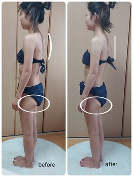 ニワ(Niwa)/ヒップライン変化例