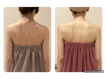 ボーテ(beaute)/【ビフォーアフター】