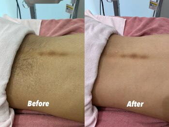 クイーン 渋谷店(QUEEN)/意外と見える腰回り