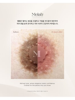 ユーエステティック(U AESTHETIC)/