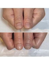 キュア(Cure.)/ジェル等を使わない地爪育成ケア