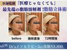 従来の3倍！脂肪分解剤Dr’sメソ　フェイシャル16500円→8800円