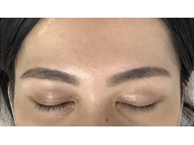 メモット 自由が丘(MEMOTTO)/施術後