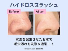ベルフィーヌ 桐生店(BELFINE)/ハイドロスプラッシュ