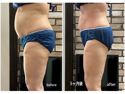 サクラメイト(咲楽メイト)の写真