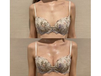 IBC 上大岡店/Before-After