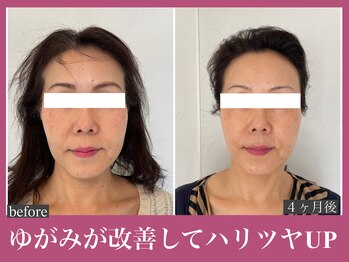 アクアビー(AQUA-B)/