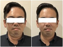 美容整体 ウェリナ 蟹江院/小顔矯正/骨盤矯正/美脚サロン 