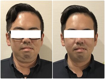 美容整体 ウェリナ 蟹江院/小顔矯正/骨盤矯正/美脚サロン