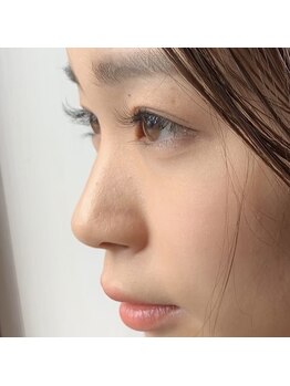 ファボリ ナゴヤ(favori nagoya)/LEDマツエク