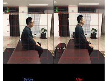 ストレチックス 近江八幡店/姿勢・腰痛改善ビフォーアフター