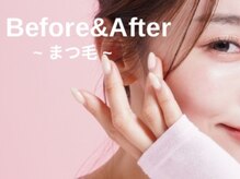 レピア 表参道店/まつ毛パーマ上下×マツパ