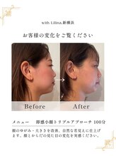 ウィズリリナ 新横浜(with Lilina.) 人気No.1 コース1回