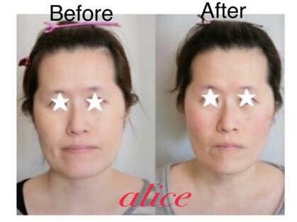 アリス(alice)の写真