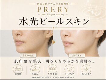 プレリー 自由が丘店/水光ピールでなめらかな艶肌へ