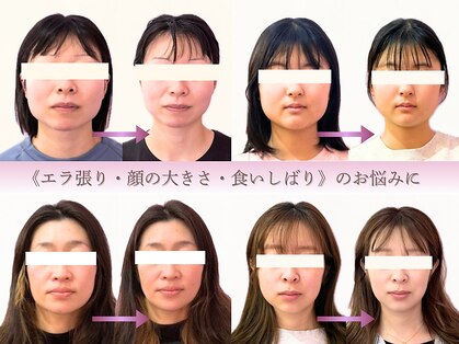 ハル(haru.)の写真