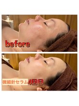 ヌーベルコピーヌ 五井店/何歳からでも変われます！！