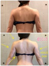 エクセレントビューティーサロン 艶(EN)/減量プログラム　ブライダル４回