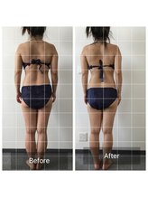 ボディメイクサロンアプローズ/背中に流れた副乳を元の位置へ